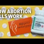 safe abortion